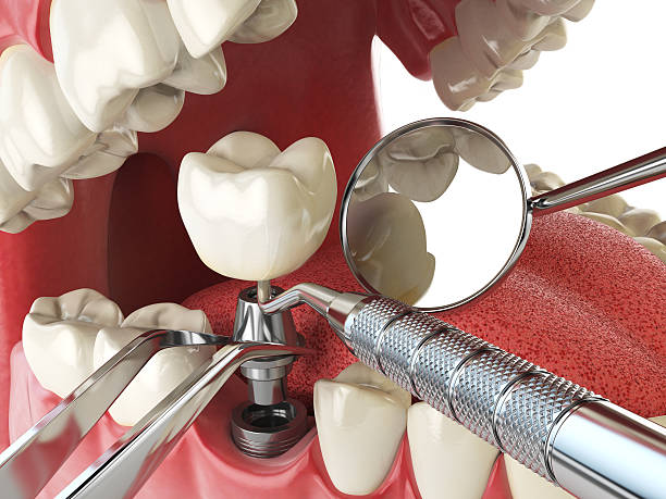 Best Emergency Orthodontic Repairs in Bel Air North, MD